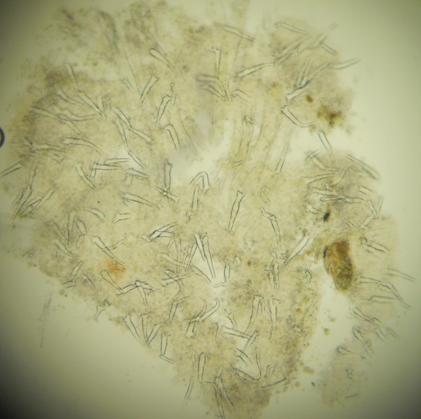 Tubulicrinis? (Tubulicrinis subulatus)